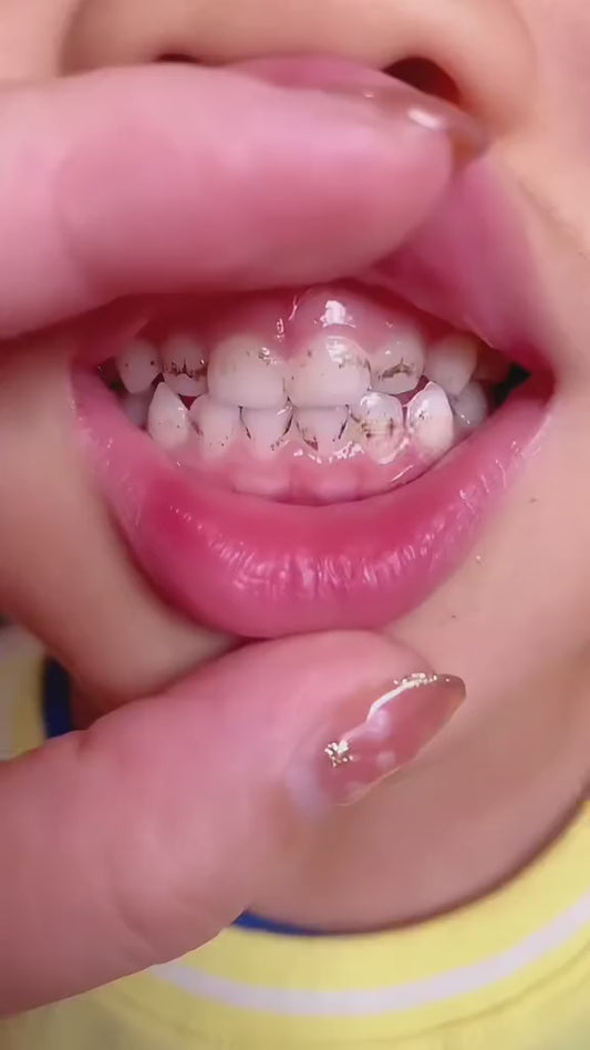 🪥 Cepillo de Dientes infantil U 👶✨